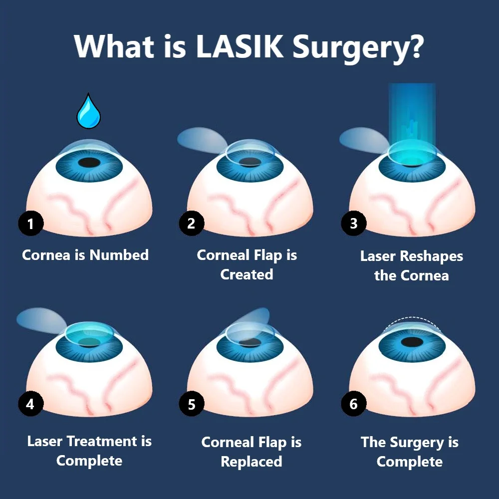 Advanced LASIK Techniques and Pain Management
