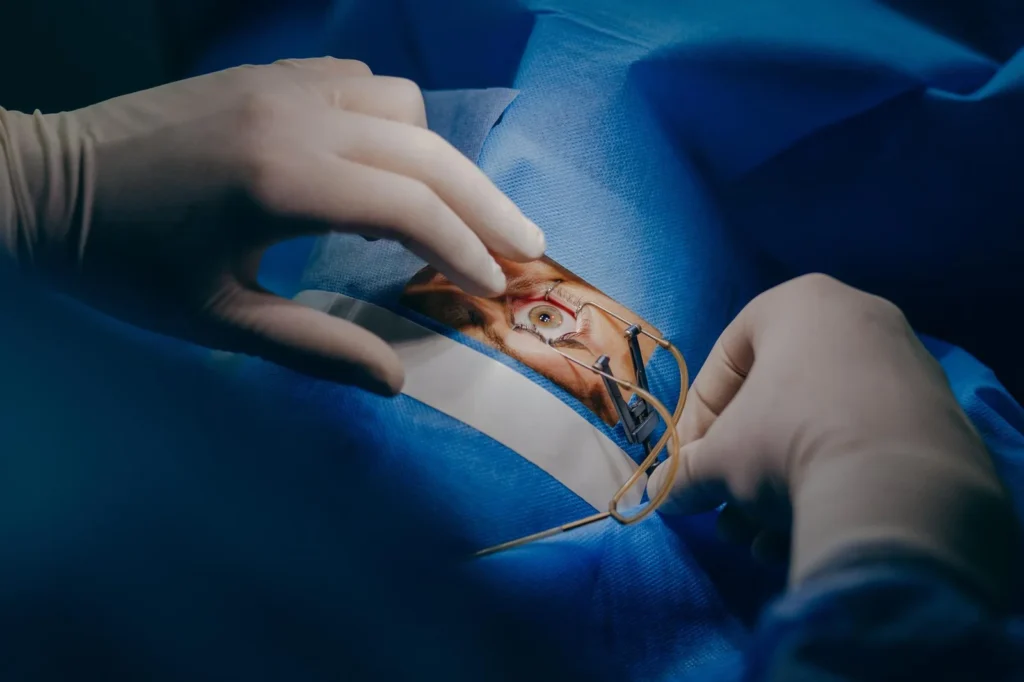 Blade-Free vs Traditional Cataract Surgery: What’s Safer for You in 2025?