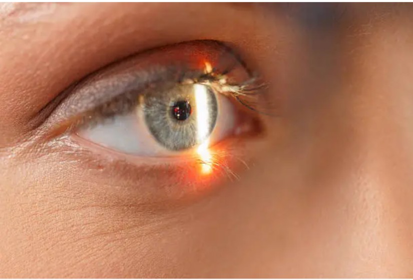 Best LASIK Eye Surgery in Pune: Debunking Myths, Surgery Costs, and Best Options